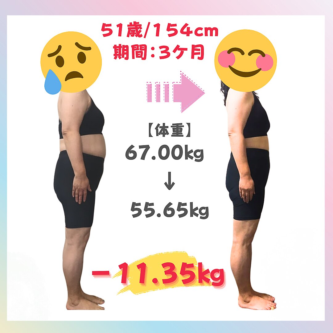 筋膜リリースの施術イメージ